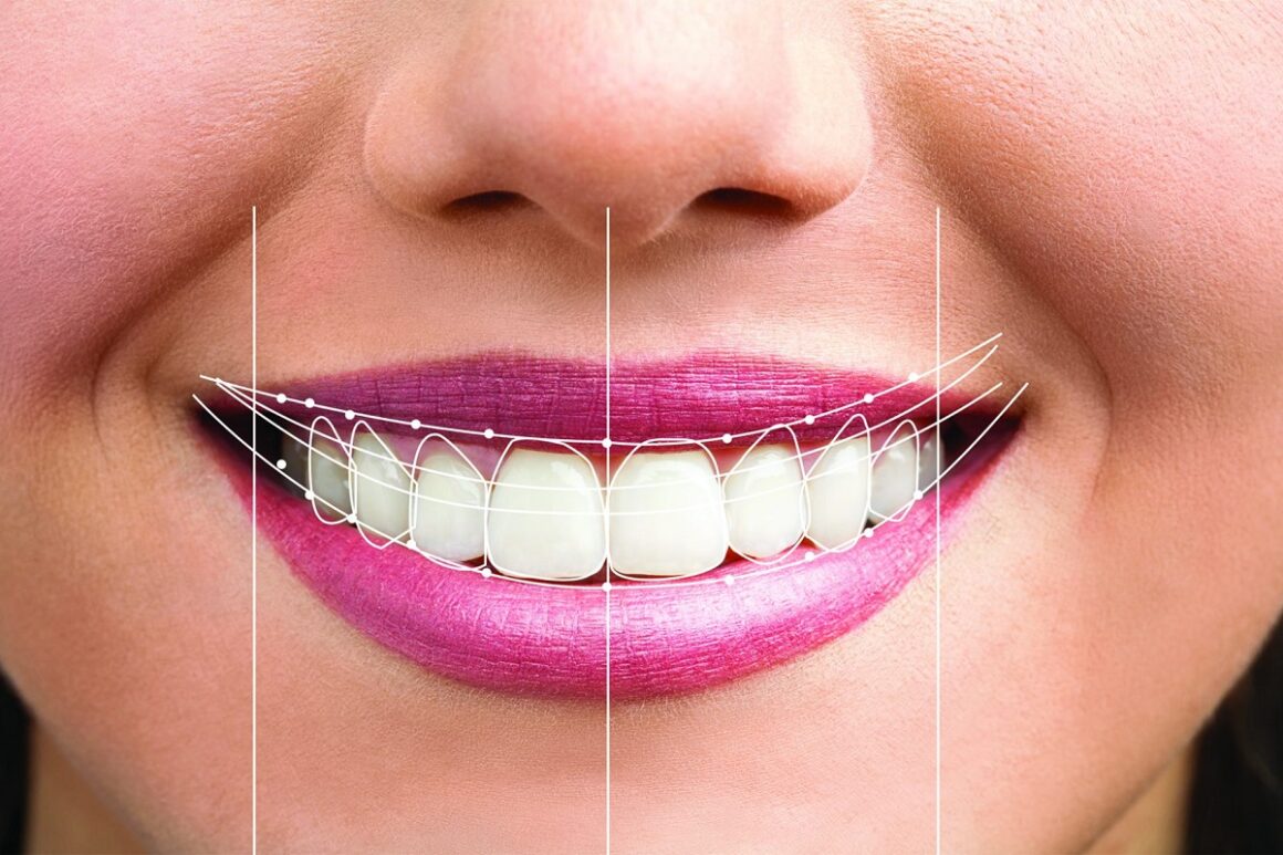 Dental-smile-design-img Smile Designing