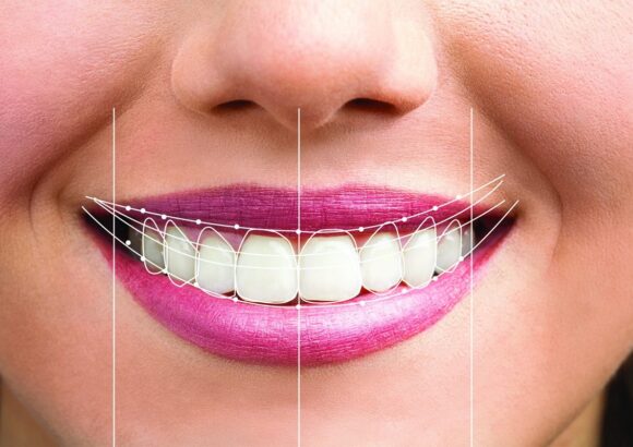 Dental-smile-design-img Smile Designing