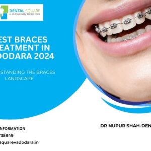 Best Braces Treatment in Vadodara 2024