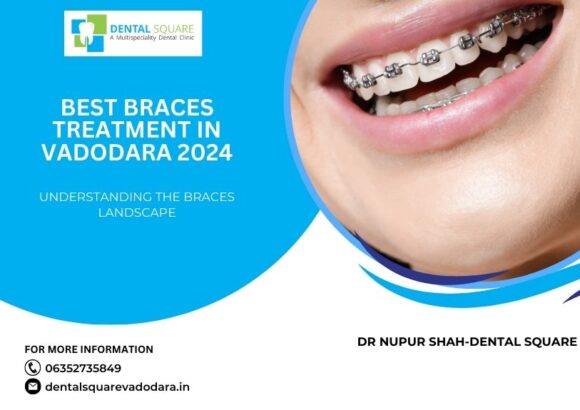 Best Braces Treatment in Vadodara 2024