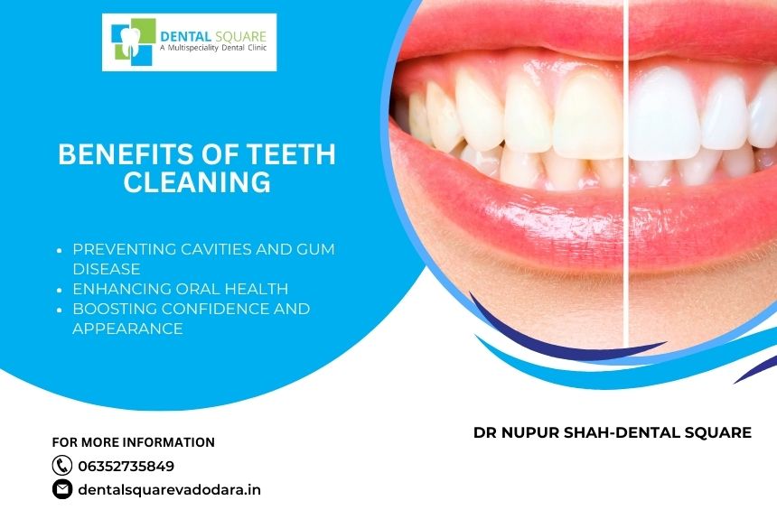Best Teeth Cleaning Treatment In Vadodara 2024