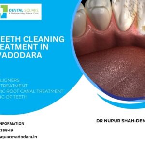 Best Teeth Cleaning Treatment In Vadodara 2024